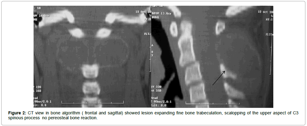 surgery-clinical-practice-bone-algorithm