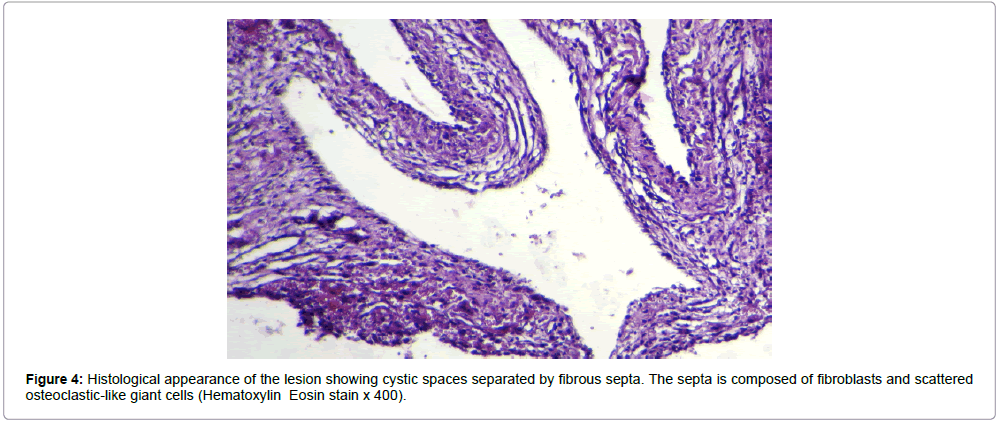 surgery-clinical-practice-cystic-spaces