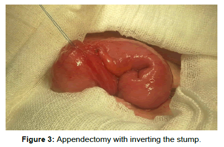 surgery-clinical-practice-inverting-stump