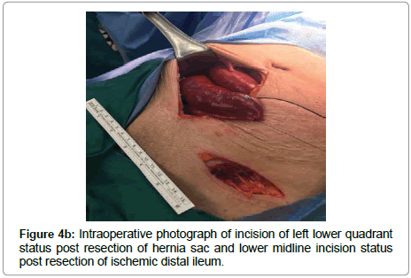 surgery-clinical-practice-lower-quadrant