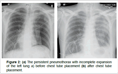 surgery-clinical-practice-lung