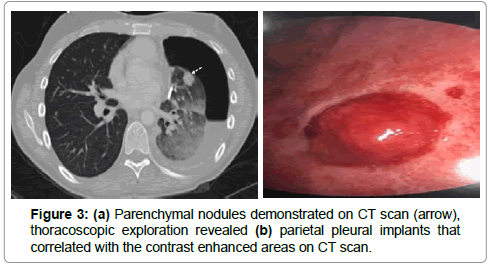 surgery-clinical-practice-nodules