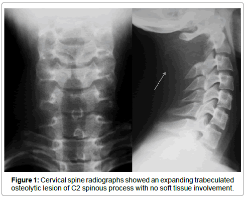 surgery-clinical-practice-osteolytic-lesion