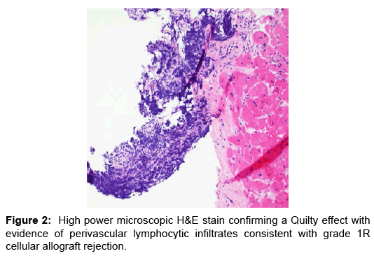 transplantation-studies-allograft-rejection