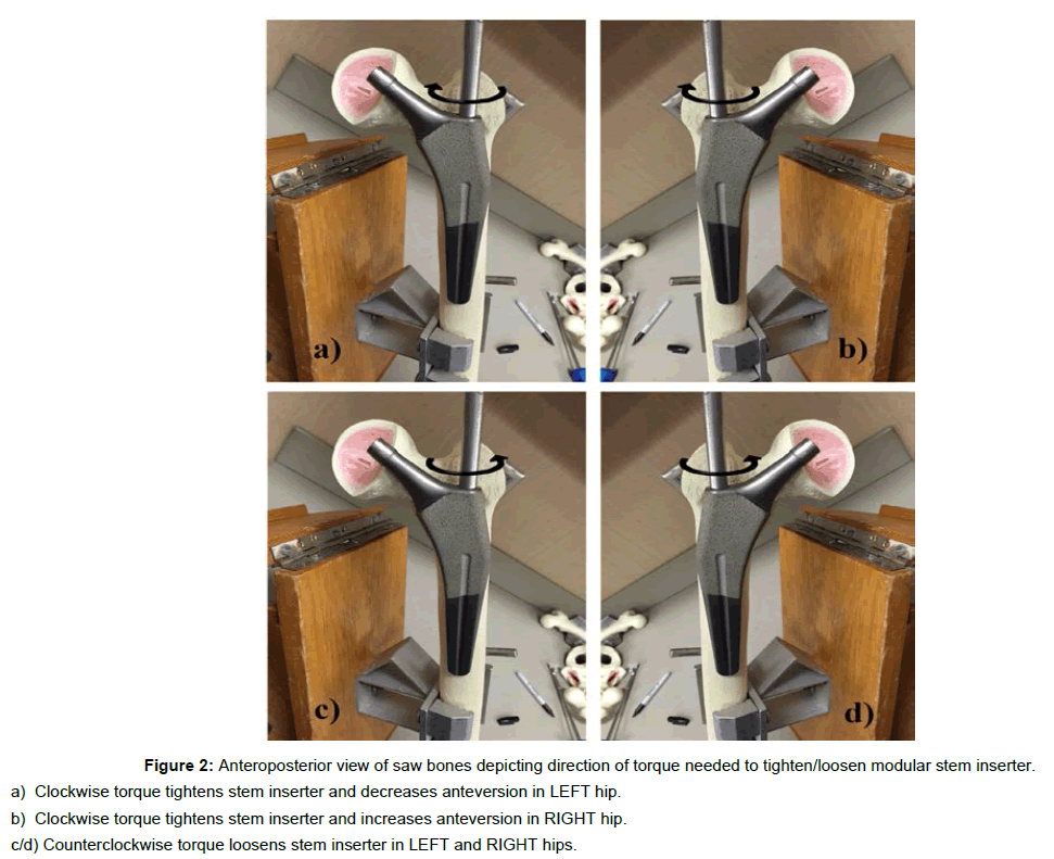 trauma-rehabilitation-modular-stem-inserter