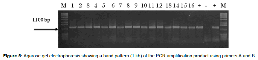 vegetos-Agarose-gel-electrophoresis