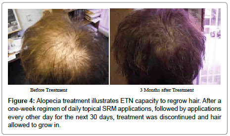 veterinary-science-Alopecia-treatment