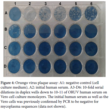 virology-antiviral-research-plaque-assay