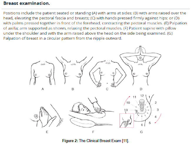 Nipple Discharge - Gynecology and Obstetrics - Merck Manuals Professional  Edition