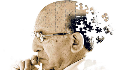 Dementia Screening Tool for the Early Diagnosis of Alzheimerâ€™s Disease