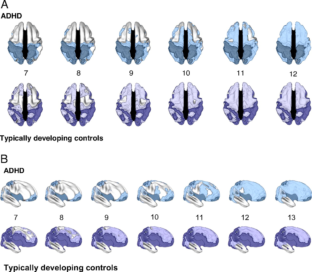 Neuro-Anatomic Evidence for the Maturational Delay Hypothesis of ADHD
