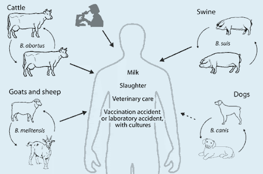 Human Brucellosis: Recent Advances and Future Challenges