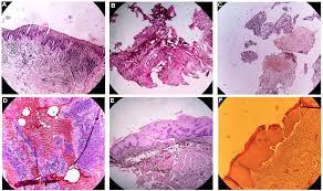 Essentials before Sending Biopsy Specimens: Pathologists Concern
