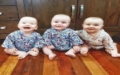 A Triplet Baby with Progressive Hydrocephalus and Neurodevelopmental Delay