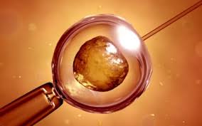 IVF-ICSI Split Insemination Reveals those Cases of Unexplained Infertility
Benefitting from ICSI Even when the DNA Fragmentation Index is Reduced to 15% or Even 5%