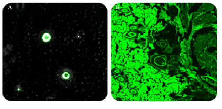 Proniosomal Gel Based Delivery System of Aceclofenac for Ocular Delivery with Improved Safety and Efficacy