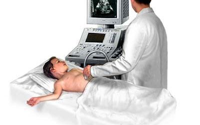 Dexamethasone Provides Longer Analgesia than Tramadol when Added to Lidocaine after Ultrasound Guided Supraclavicular Brachial Plexus Block. A Randomized,Controlled, Double Blinded Study