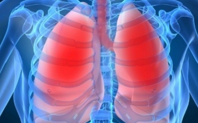 Transbronchial Migration of Double Lumen Tube during Lobectomy