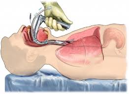 Major Tracheal Injury with Head and Neck Emphysema Complicating Intubation in Elective Surgery: Diagnostic Aspects and Management in a Resource-Limited Setting