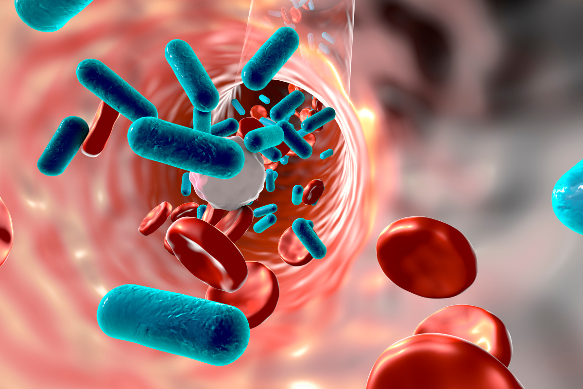 Bifidobacterium longum BB536 and Changes in Septicemia Markers Associated with Antibiotic Use in Critically Ill Patients