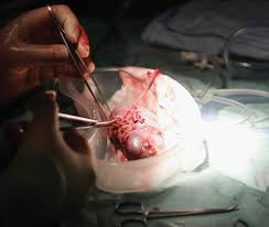11th International Conference on General Surgery and Surgical Research