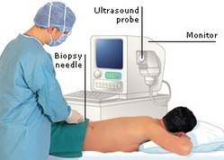 Renal Disease Diagnosis on Graft Survival in Kidney Transplant