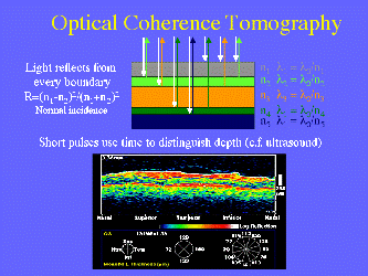 The Use of Vibrational Optical Coherence Tomography in Matching Host Tissue and Implant Mechanical Properties