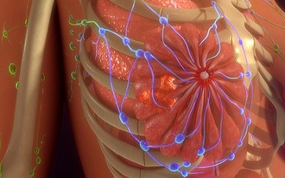 Development and application of bioengineered artificial tumor tissues to effectively model breast cancer generation, progression and metastasis