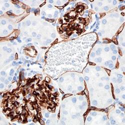 Immunohistochemical Markers of Angiogenesis and  Apoptosis in Chorionic Villi during Early Pregnancy Miscarriage