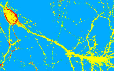 HepaRG: An Emerging In vitro Tool