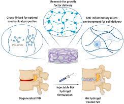 Differentiation and Regulation in Intervertebral Disc Degeneration
