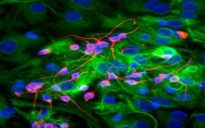 Antioxidant-Dependent Prevention of H2O2-Induced Premature Senescence in
Human Endometrial Stem Cells