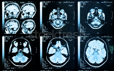 Application of Magnetic Resonance Technologies to Cell Biology