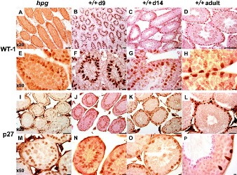 Morphological and Morphometric Study of the Development of Leydig Cell population of Donkey (Equus asinus) Testis from Birth to Maturity