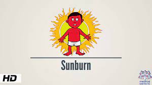 Sunburn: Causes, Signs and Prevention