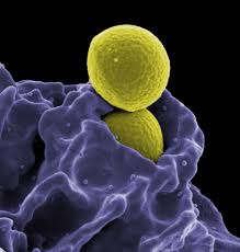 A Brief Note on Evolution on Immunology
