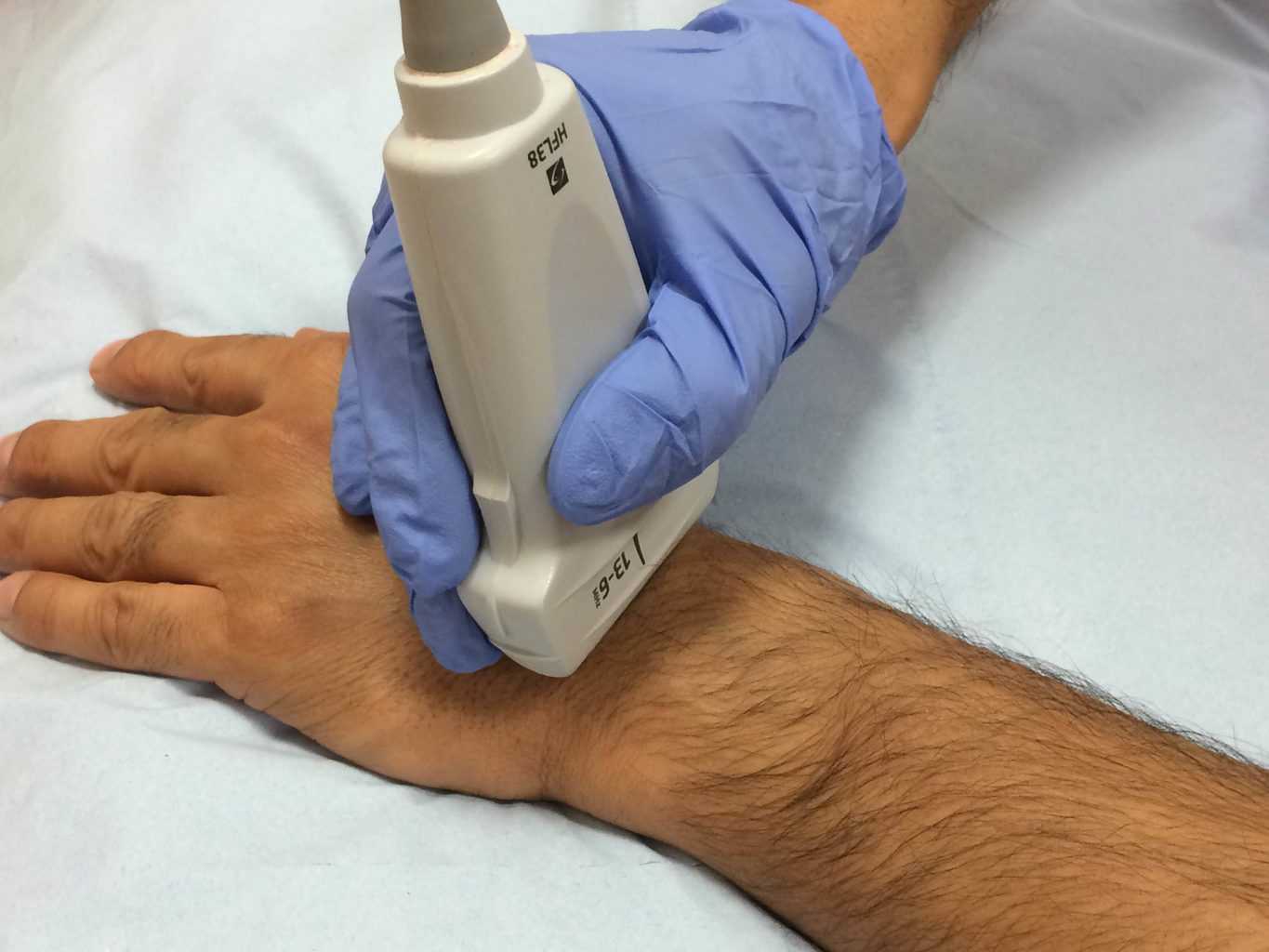 Evaluation of Non-Traumatic Painful Wrist with High Resolution Sonography