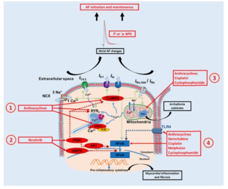 Gemcitabine Cardiotoxicity: Two Case Report and Review of the Literature