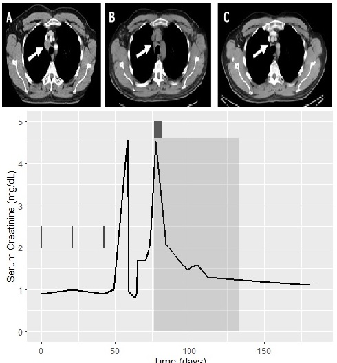 Mycophenolate as Primary Treatment for Immune Checkpoint Inhibitor Induced Acute Kidney Injury in a Patient with Concurrent Immunotherapy-Associated Diabetes: A Case Report