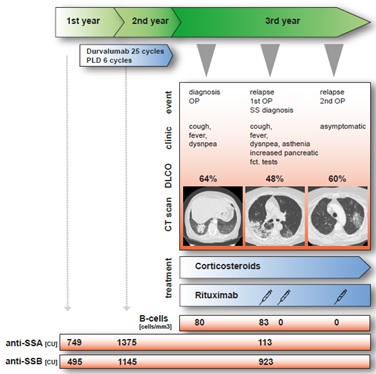Successful Treatment with Rituximab of Sjögren’s Syndrome-Associated Organizing Pneumonia in a Patient Treated with PD-L1 Blockade for Ovarian Cancer