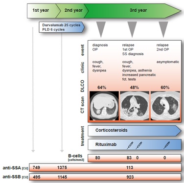 Successful Treatment with Rituximab of SjÃ¶grenâ€™s Syndrome-Associated Organizing Pneumonia in a Patient Treated with PD-L1 Blockade for Ovarian Cancer