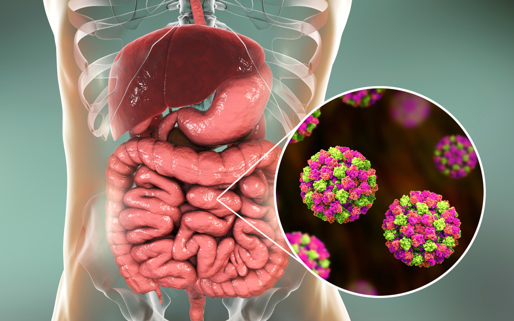 First Case Report of a Life-Threatening Rotavirus Gastroenteritis in a Breast Cancer Patient Receiving Pertuzumab and Trastuzumab