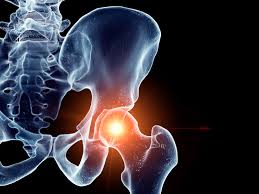 HIP Fracture Evaluation