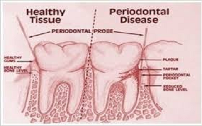 Global Dentists and Paediatric Dentistry Annual Meeting-2020 scheduled during March 30-31, 2020 London, UK