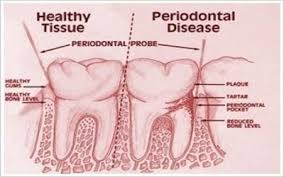 Young Research Forum on Advanced Dentistry and Dental science, March 23-24, 2020 | Toronto, Canada