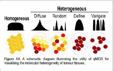 Can Challenges of Oral Cancer Diagnosis be Resolved?