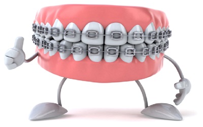 Attitude of Patients towards Orthodontic Treatment: A Questionnaire Survey