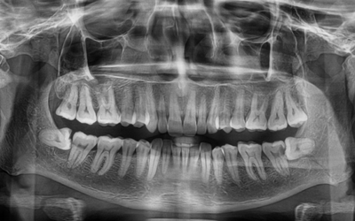 Trends in Magnetic Resonance Imaging Research in Dentistry