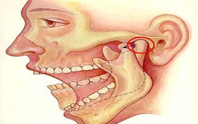 Pursuit of the Best Evidence
Base: Implications for Treatment
for Temporomandibular
Joint Disorders by Means of
Mindfulness Meditation