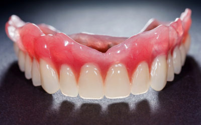 Impression Techniques and Materials for Complete Denture Construction